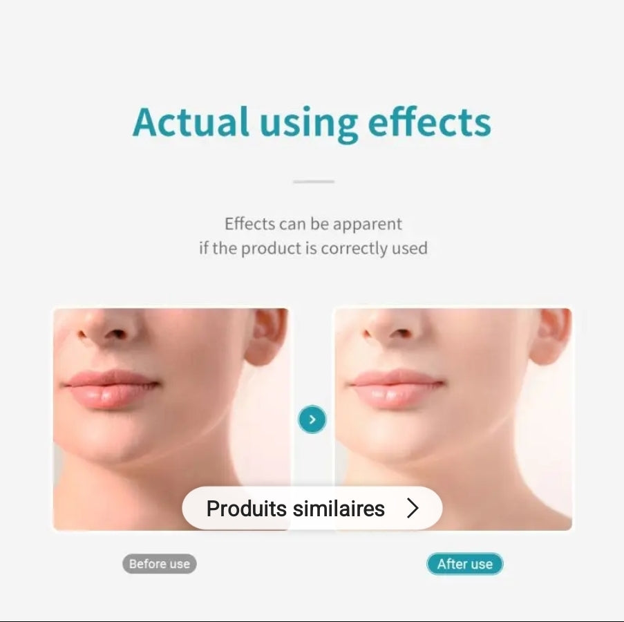 LANBENA ACNE TREATMENT FACIAL CLEANSER
