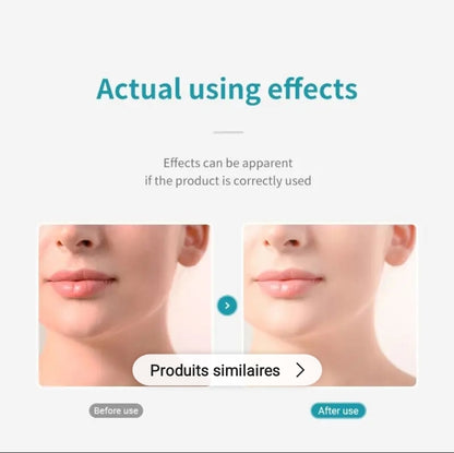 LANBENA ACNE TREATMENT FACIAL CLEANSER
