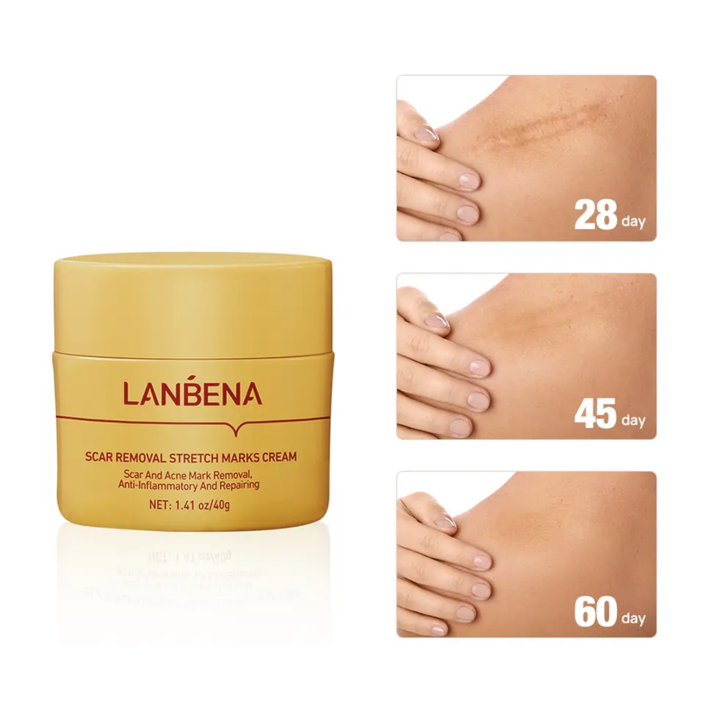LANBENA Herbal Acne Scar Removal Stretch Marks Cream Skin Repair Nigth Cream