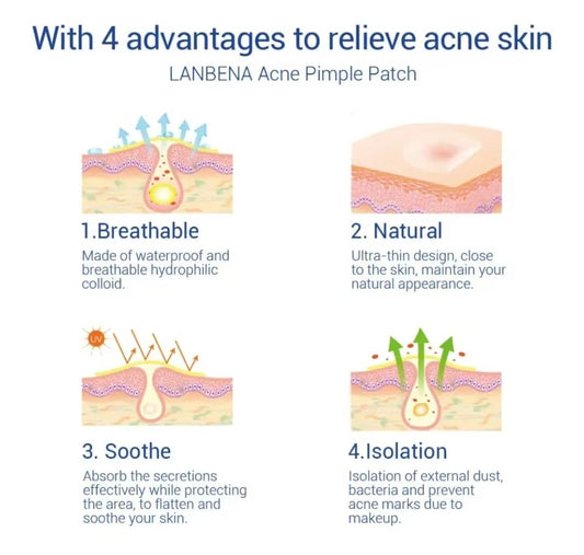 LANBENA Acne Pimple Patch – Usage de Jour (0.1 mm | 25 patches)